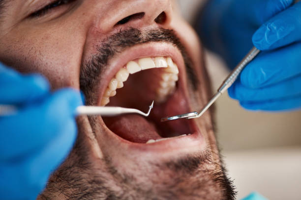 Best Weekend Emergency Dentist in Garfield, TX