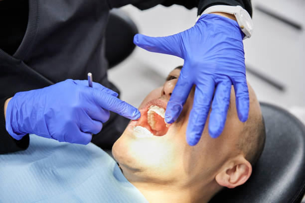 Best Emergency Dentist for Lost Fillings or Crowns in Garfield, TX